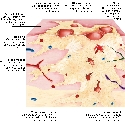 Malignant tumour growth
As abnormal cells...